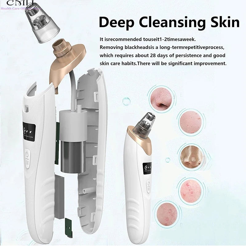 Blackhead Remover Pore Vacuum