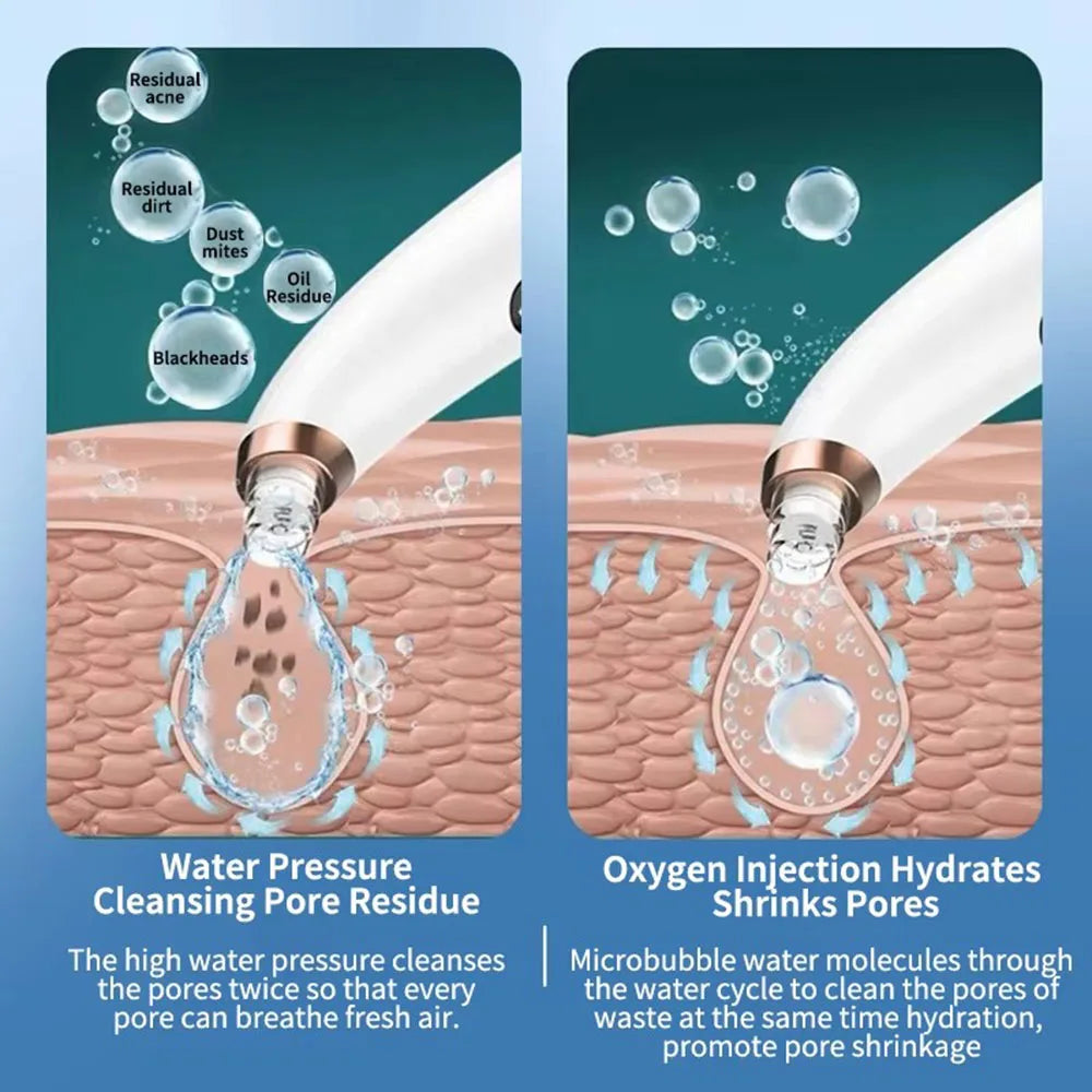 Pore vacuum suction heads detail